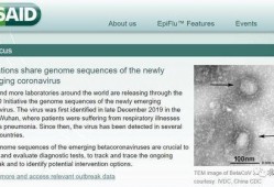 美国病毒爆料最新,揭秘疫情背后的真相与挑战